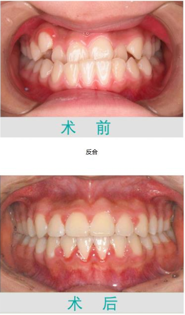 珠海鼎植口腔醫(yī)院