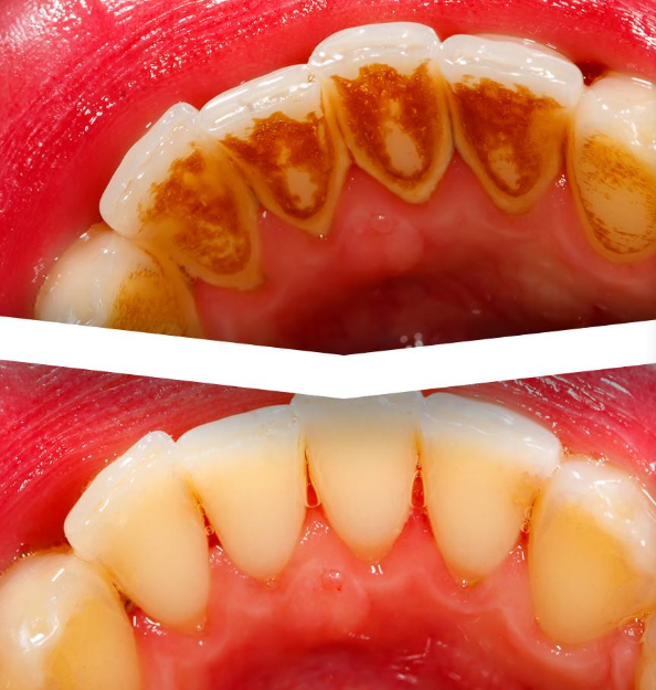 珠海六和口腔醫院