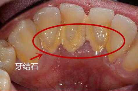 珠海鼎植口腔醫院