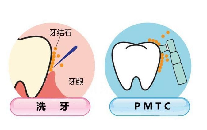 珠海口腔醫(yī)院PMTC