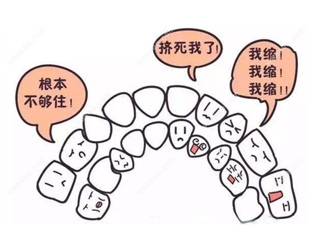 珠海鼎植口腔醫(yī)院牙齒擁擠