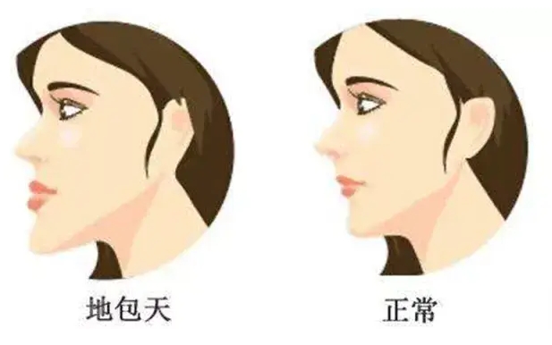 珠海六和口腔醫(yī)院地包天
