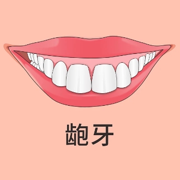珠海鼎植口腔醫院齙牙